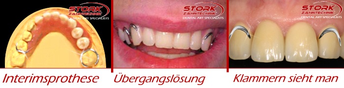 Klammern im Sichtbereich sind st&ouml;rend