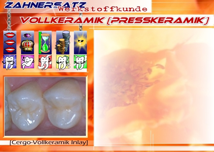 Vollkeramik (Presskeramik)